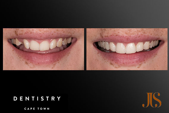 Comprehensive Reconstruction