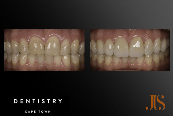 Comprehensive Reconstruction