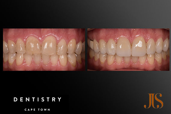 Comprehensive Reconstruction