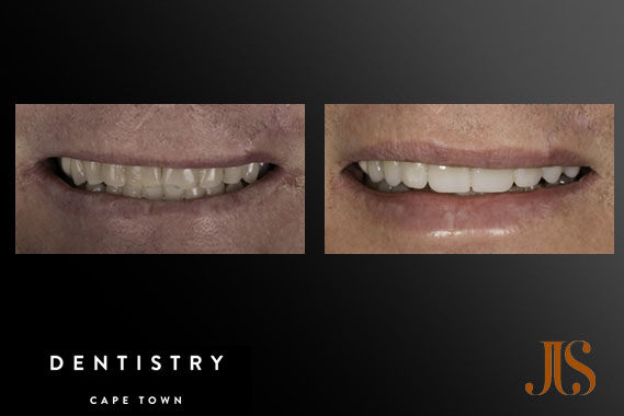 Comprehensive Reconstruction