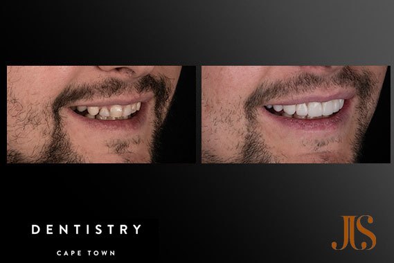 Comprehensive Reconstruction