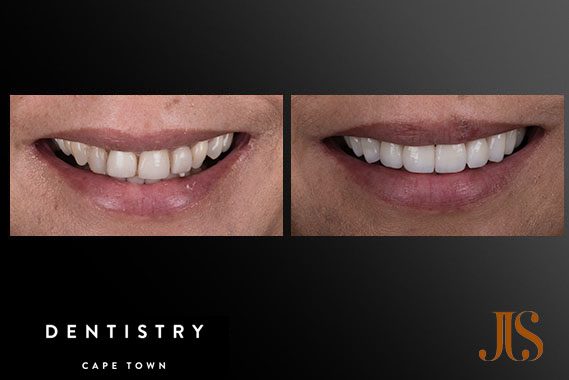 Comprehensive Reconstruction