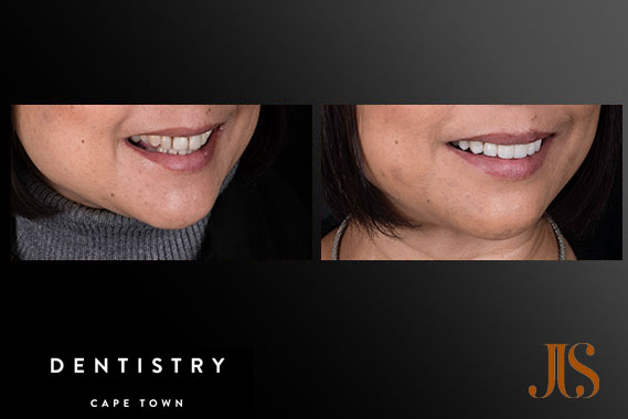 Comprehensive Reconstruction