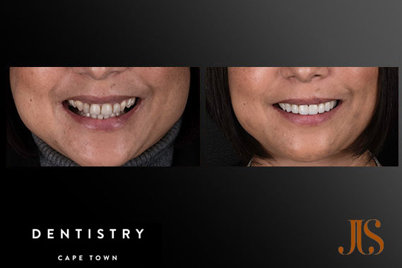 Comprehensive Reconstruction