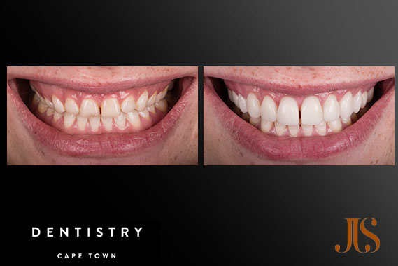 Comprehensive Reconstruction