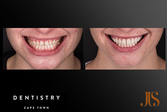 Comprehensive Reconstruction