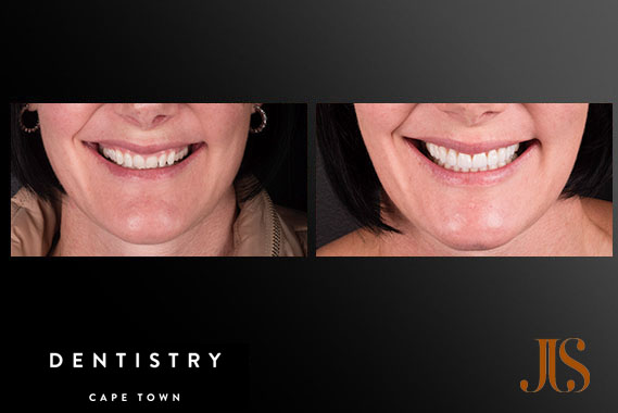 Comprehensive Reconstruction