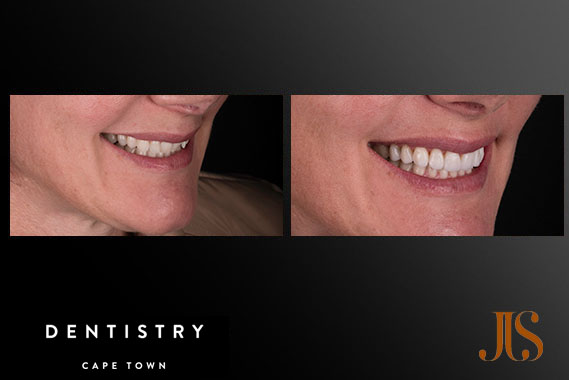 Comprehensive Reconstruction