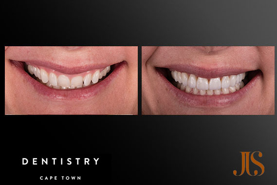 Comprehensive Reconstruction