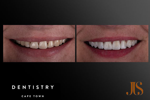 Cosmetic Dentistry