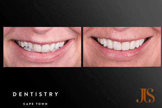 Cosmetic Dentistry