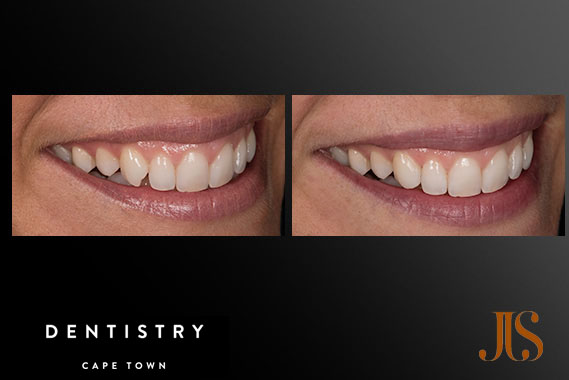 Cosmetic Dentistry
