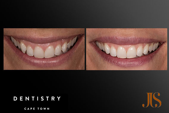 Cosmetic Dentistry