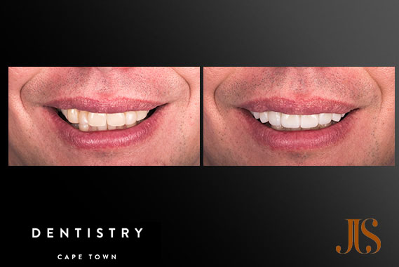 Cosmetic Dentistry