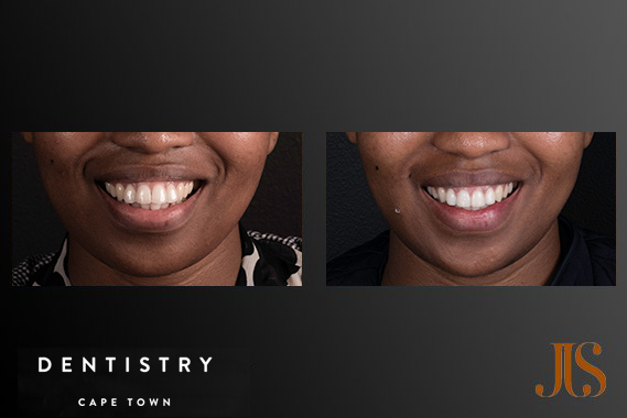 Orthodontics Cape Town