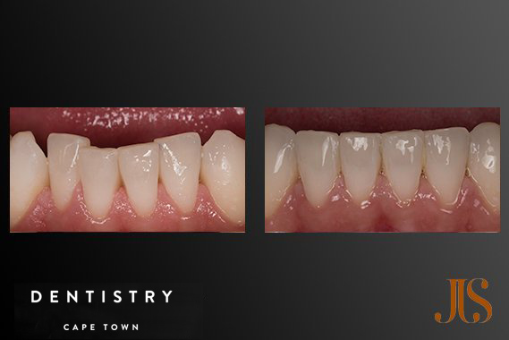 Orthodontist Cape Town