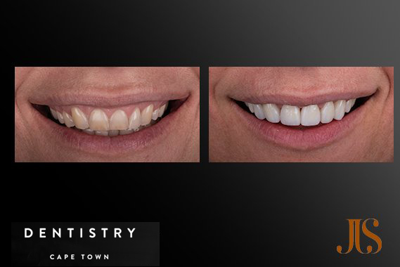 Cosmetic Dentist Cape Town