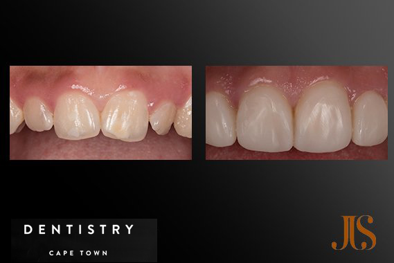 Cosmetic Dentistry South Africa