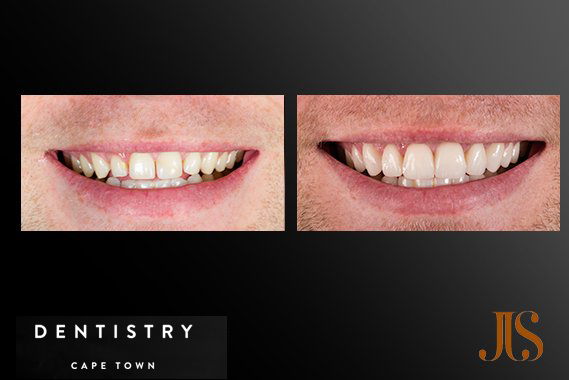 Cosmetic Dentistry South Africa