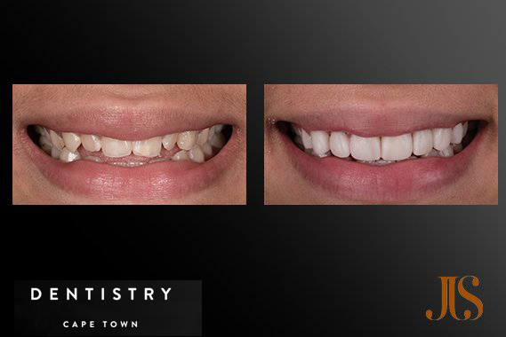 Cosmetic Dentistry
