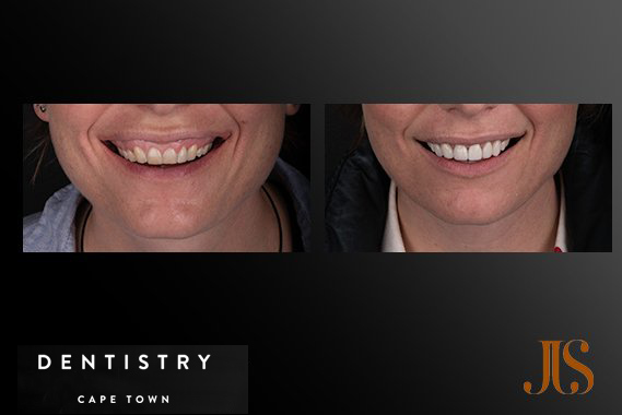 Cosmetic Dentistry