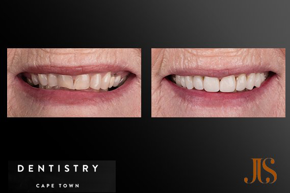 Cosmetic Dentist Cape Town
