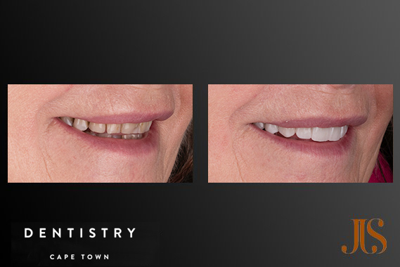 Cosmetic Dentistry