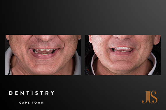 Comprehensive Reconstruction