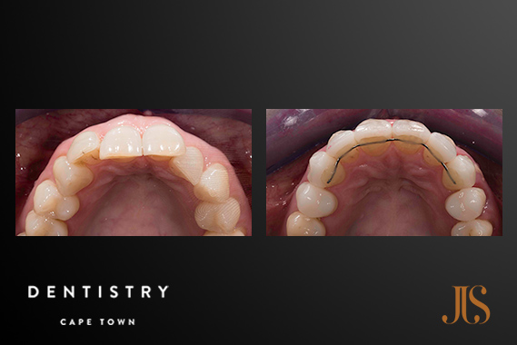 Comprehensive Reconstruction