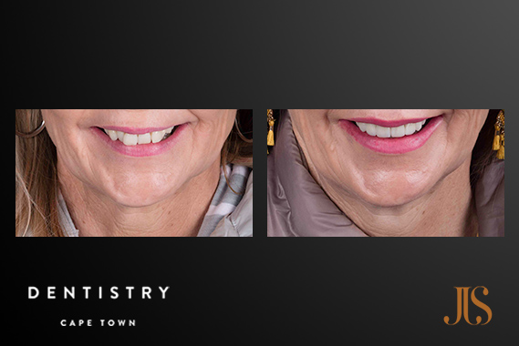 Comprehensive Reconstruction