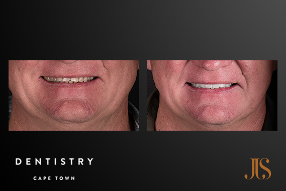 Cosmetic Dentistry