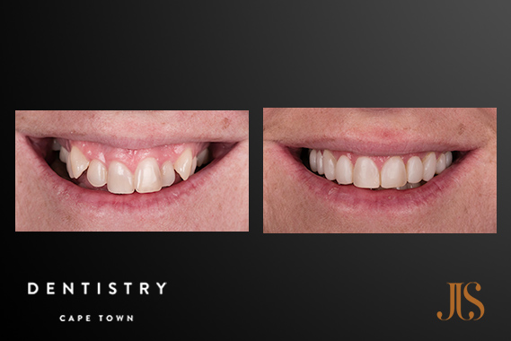 Cape Town Comprehensive Reconstructive Dentistry