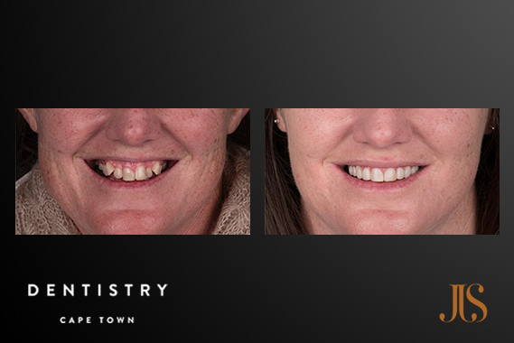Comprehensive Reconstructive Dentsitry