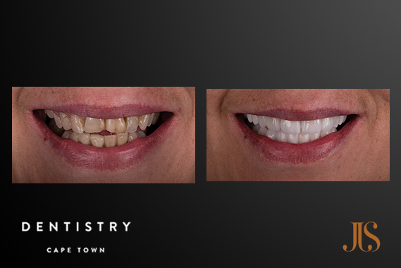 Comprehensive Reconstruction Cape Town