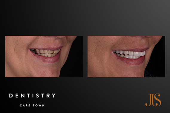 Cape Town Comprehensive Reconstruction