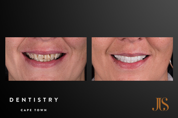 Comprehensive Reconstruction