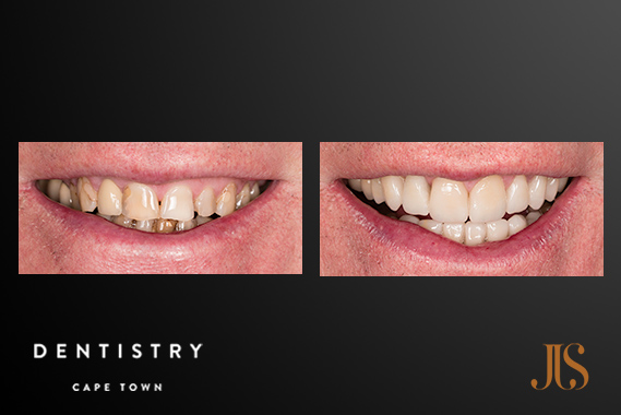 Cape Town Comprehensive Reconstruction