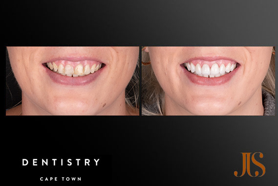 Cosmetic Dentistry