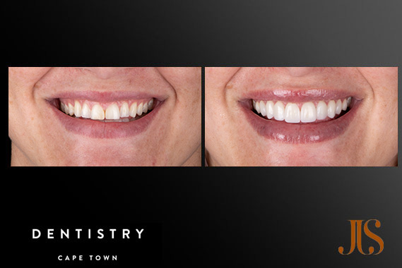 Cosmetic Dentistry