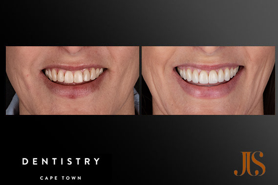 Cosmetic Dentistry