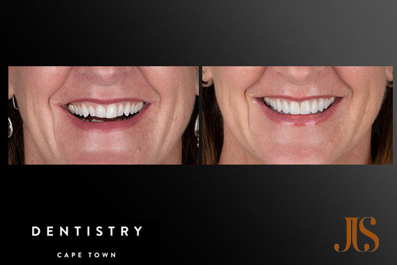 Cosmetic Dentistry