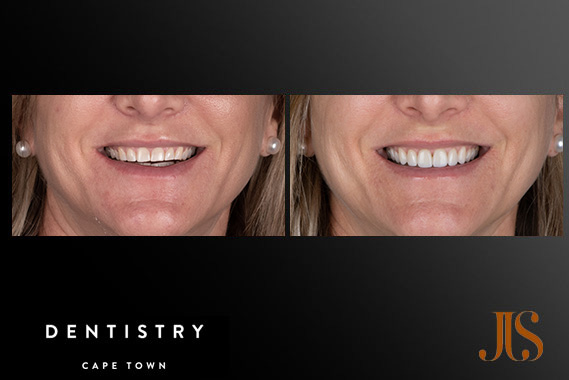 Cosmetic Dentistry