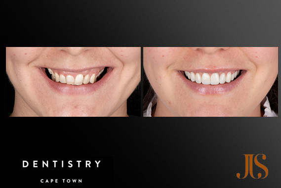 Cosmetic Dentistry