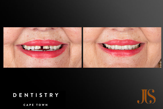 Cosmetic Dentistry
