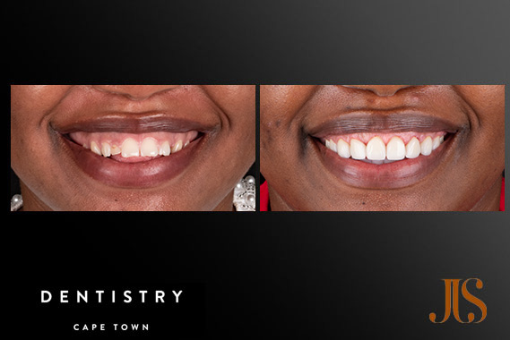 Cosmetic Dentistry