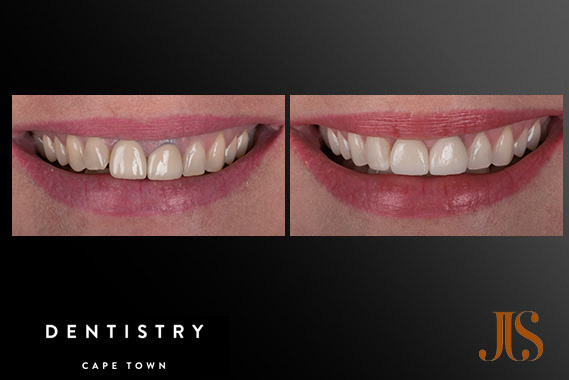 Cosmetic Dentistry