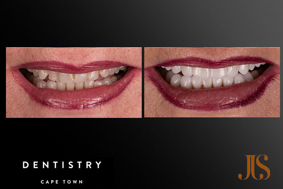 Cosmetic Dentistry