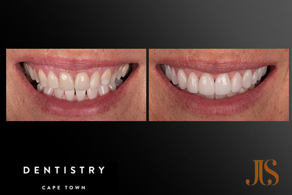 Cosmetic Dentistry