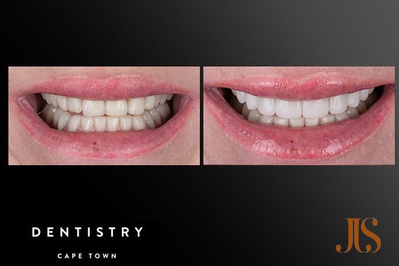 Cosmetic Dentistry