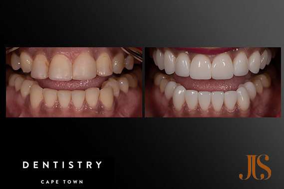 Cosmetic Dentistry